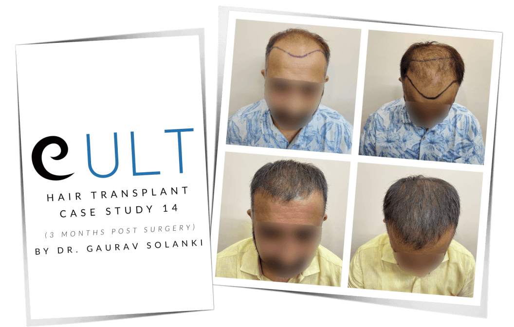 Case-Study-14-Cover-1