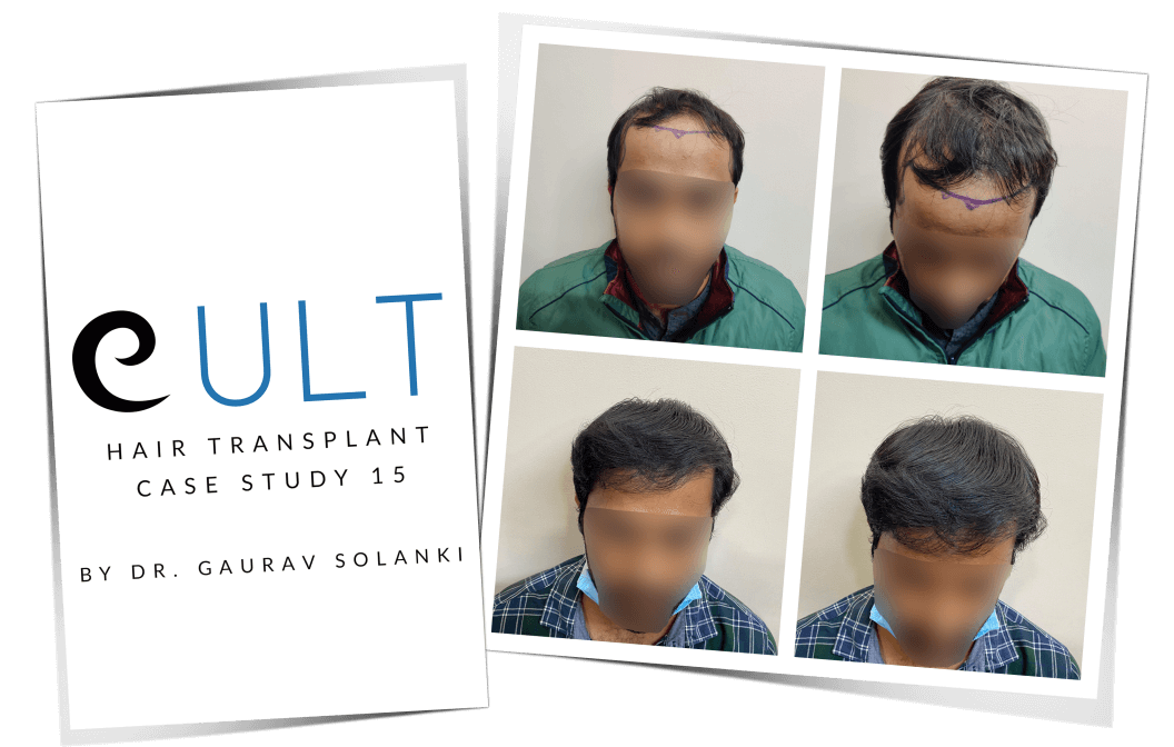 Case-Study-15-Cover