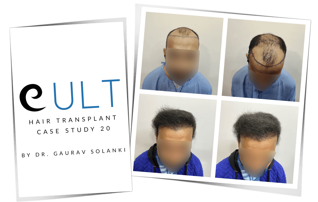 Case-Study-20-Cover