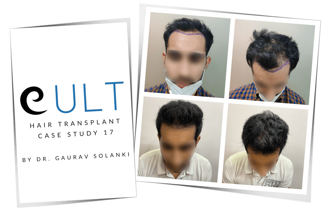 Cult-Case-Study-17-Cover
