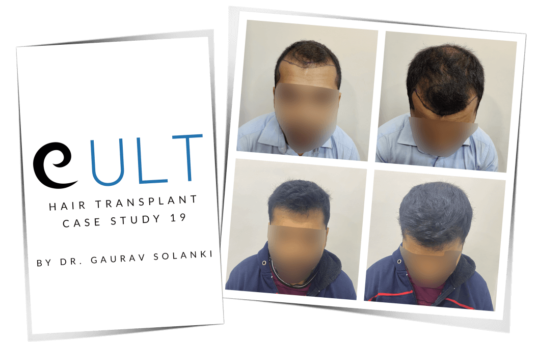 Cult-Case-Study-19-Cover